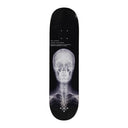Tabla Disorder Nyjah Huston Fracture